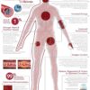 endocalyx pro information sheet
